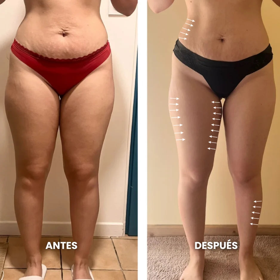 Drenaje Linfático Aurelys - Drena Naturalmente la Hinchazón del Rostro, Abdomen y Piernas