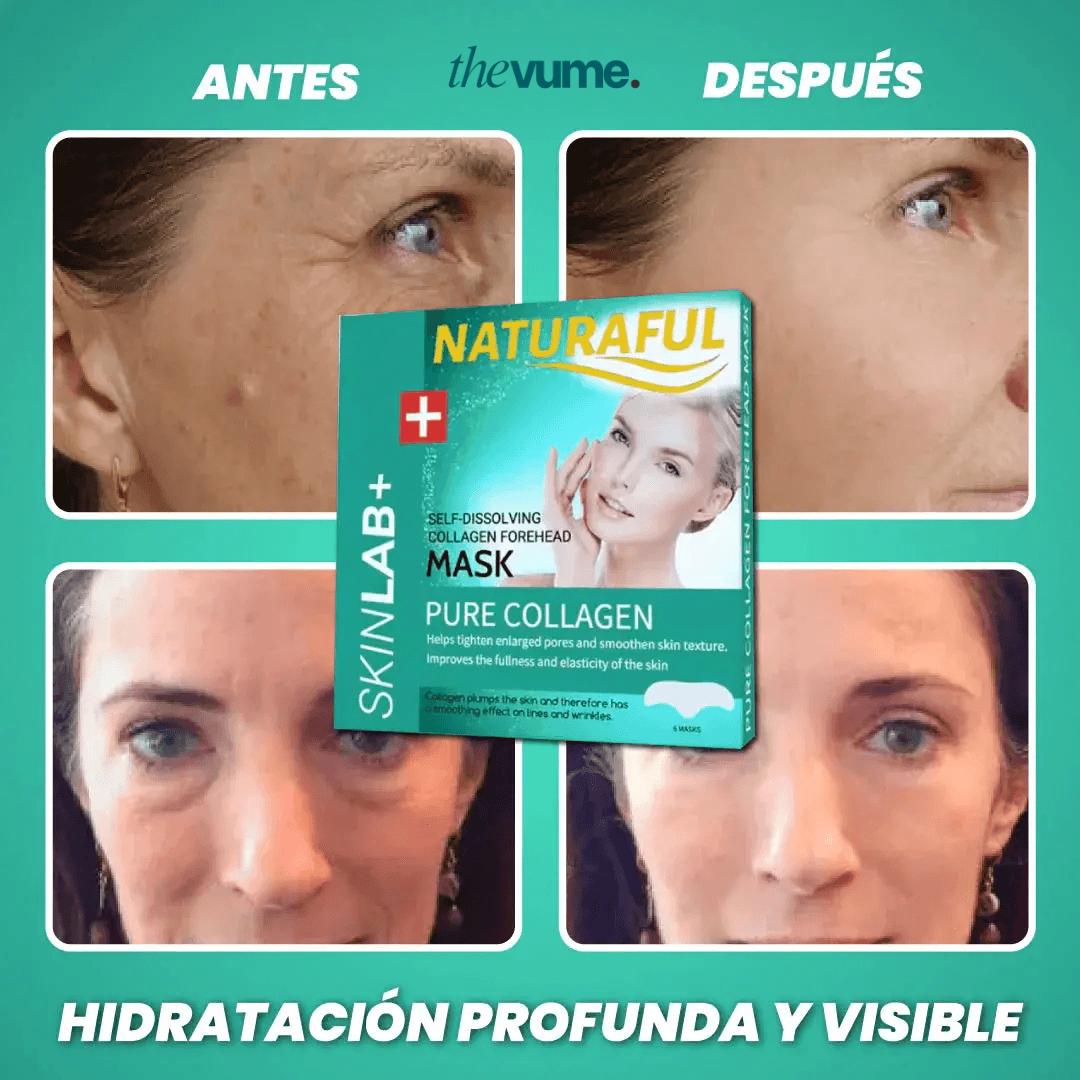 Dermalift - Parches de Colágeno para Ojeras y Bolsas