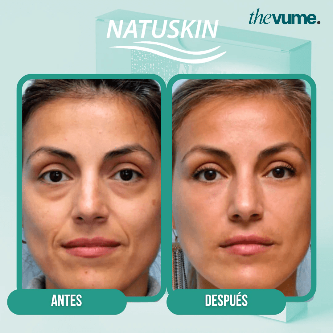 Dermalift - Parches de Colágeno para Ojeras y Bolsas