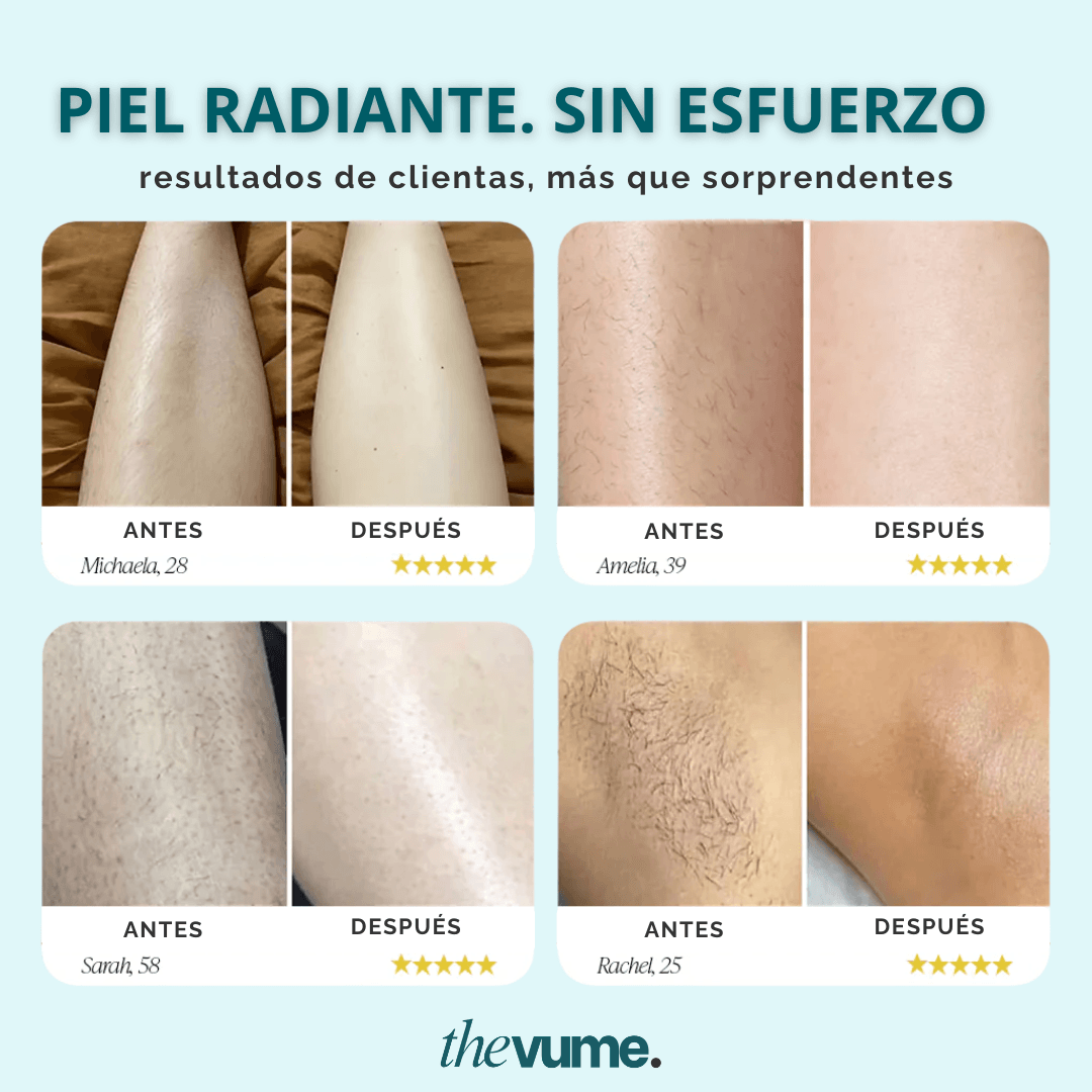 Velvet Trim - Piel lisa sin irritaciones.