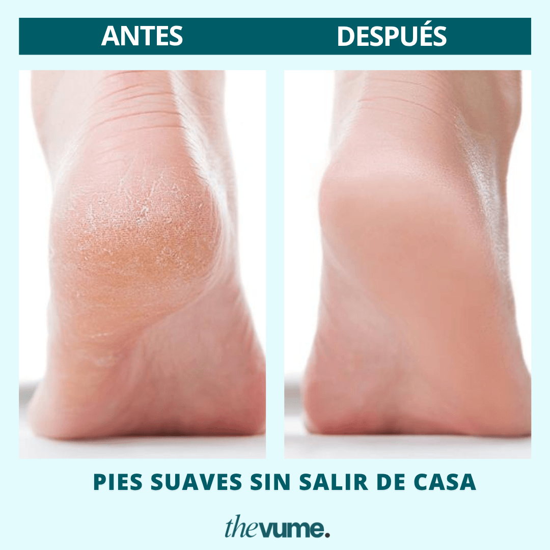 Pies suaves en minutos, desde tu casa: Lima Eléctrica Recargable ✨